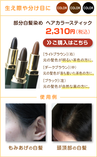 �����ݤ�ʬ���ܤ���ʬ��ȱ���ᡡ�إ����顼���ƥ��å���2,310�ߡ��ǹ��ˡ��������Ϥ�����